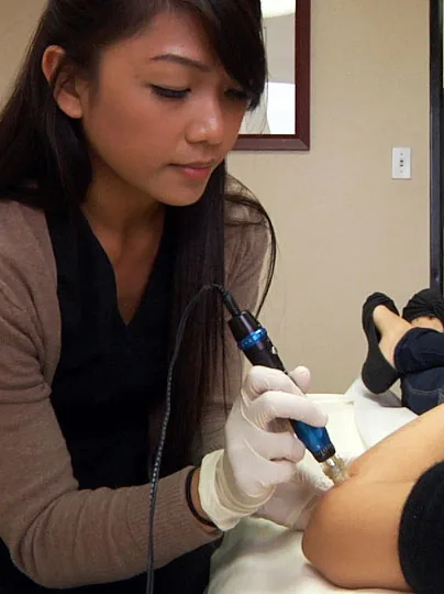 A clinician performing microneedling with a pen device